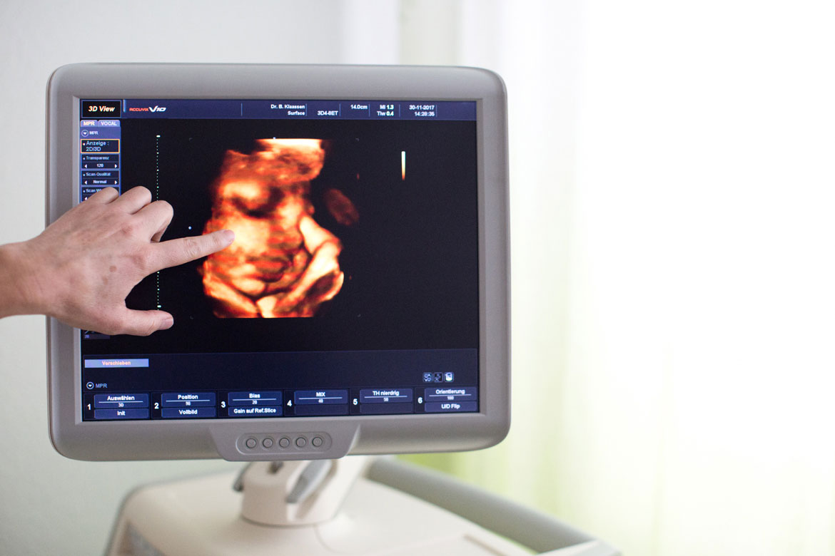 Nahaufnahme vom Ultraschall-Monitor zeigt Babygesicht